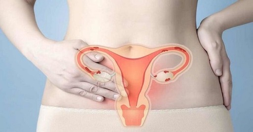 Niêm mạc tử cung khỏe mạnh là yếu tố cần thiết để thai nhi có thể phát triển tốt trong bụng mẹ